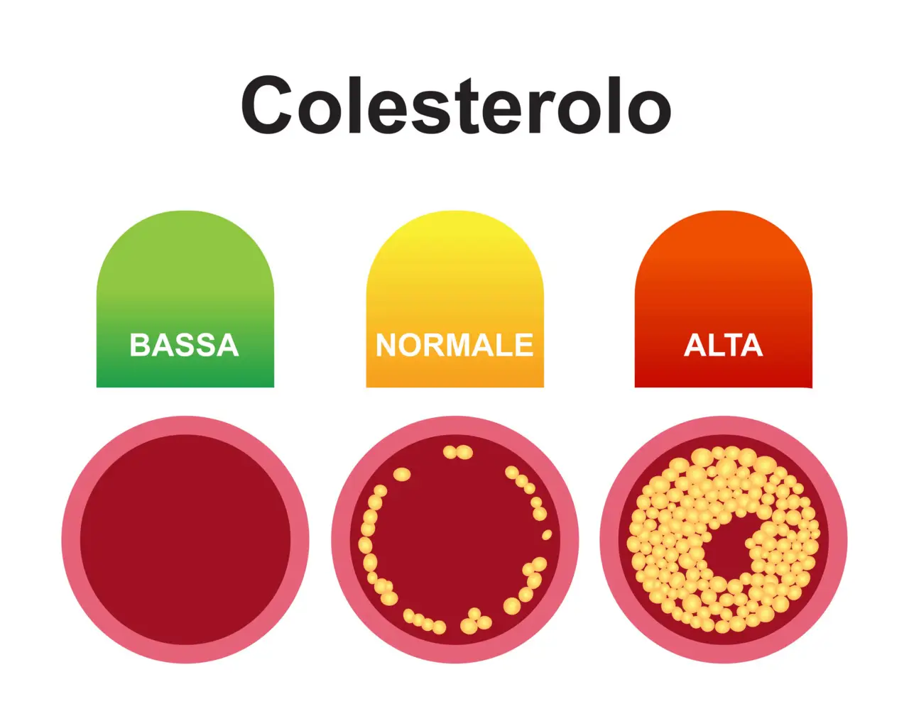 Come ridurre il colesterolo con le spezie